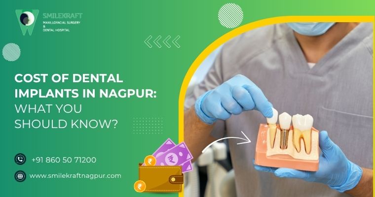 Cost of Dental Implants in Nagpur: What You Should Know? 