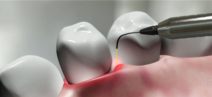painless dental treatment in nagpur