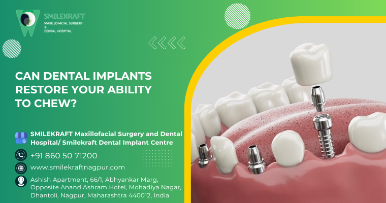 Can Dental Implants Restore Your Ability to Chew?