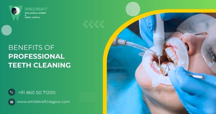 Benefits of Professional Teeth Cleaning