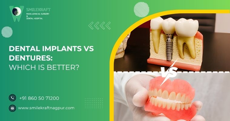 dental implants vs dentures