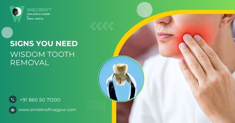 Signs You Need Wisdom Tooth Removal