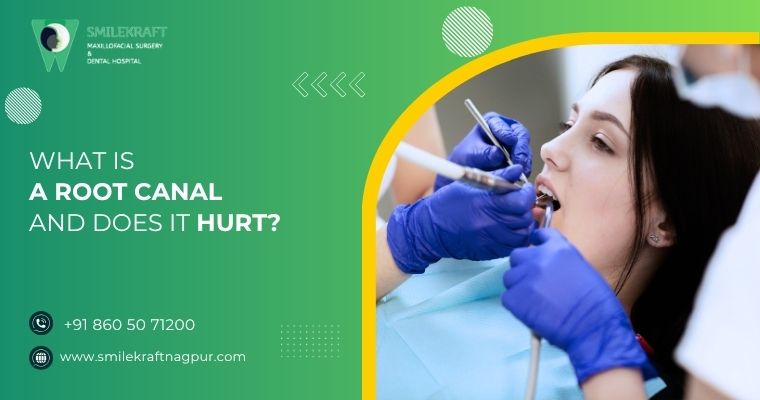 what is root canal