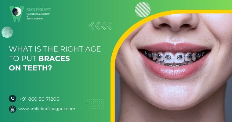 what is the right age to put braces on teeth