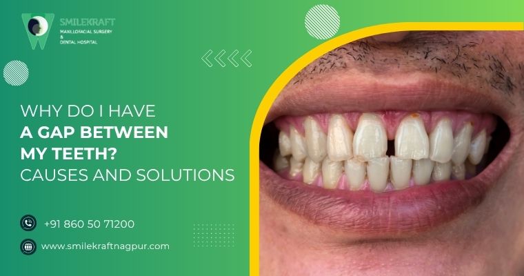 why do i have a gap between my teeth causes and solutions